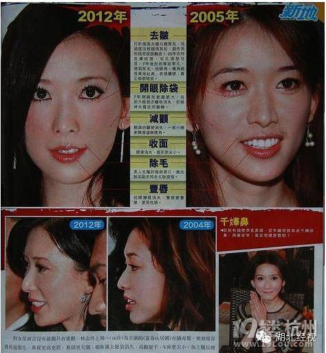 我没动过刀！女星否认整容也是蛮拼的！