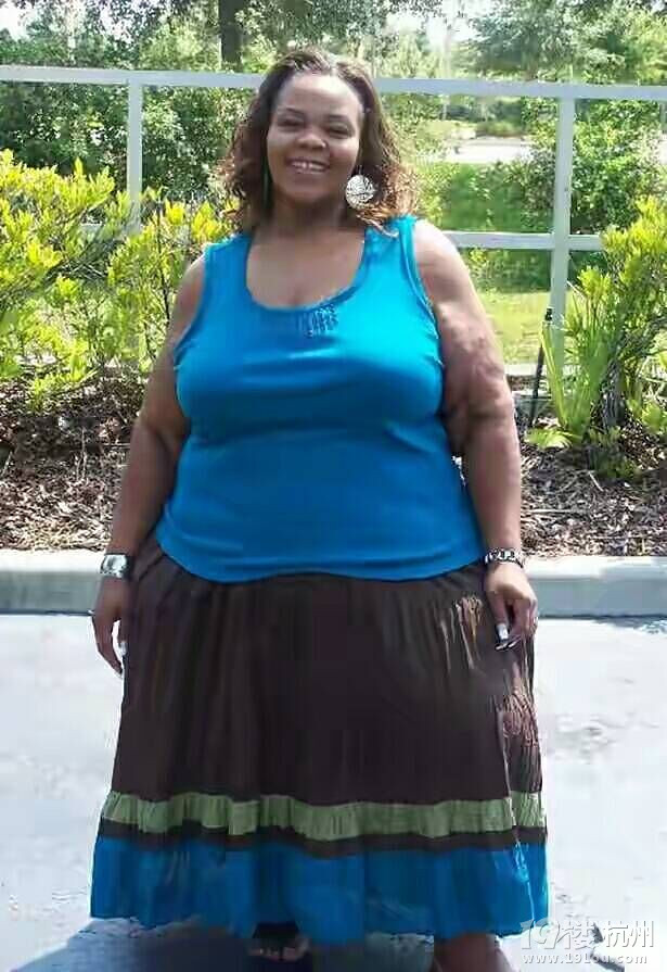 世界上最重"半吨女人" 狂瘦228公斤