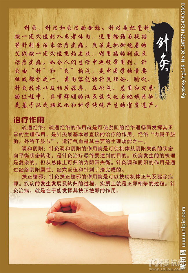 成都中医针灸点穴减肥 好处有什么? 薇莘cd-gy