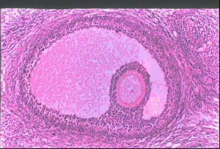 卵泡监测,可准确判断卵泡发育,排卵情况及黄体功能