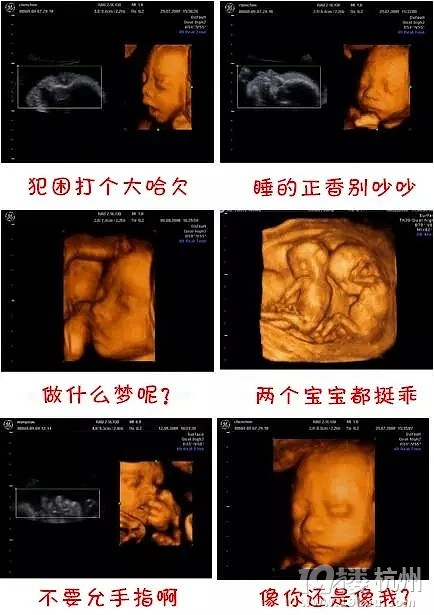 红房子妇产医院：孕育生命的乐园
