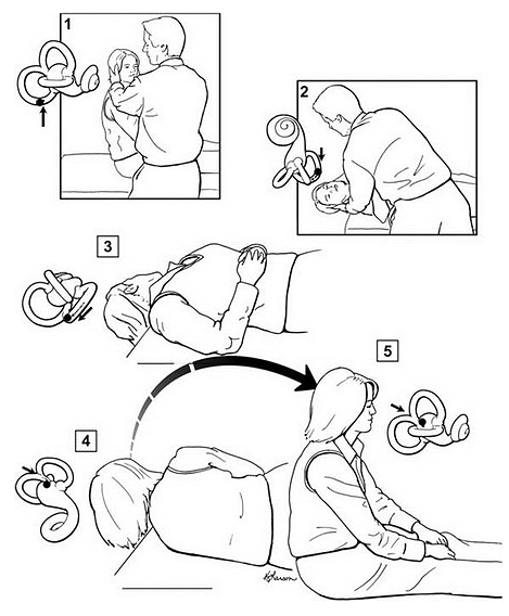 【原创】七成的头晕可能是耳朵出了问