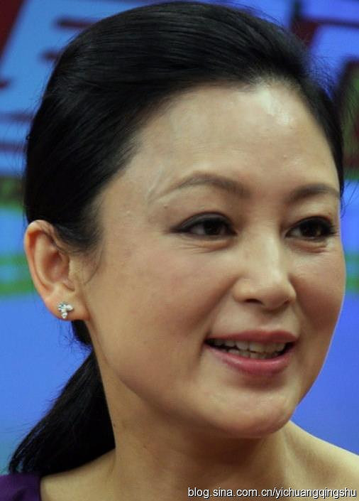 内地第一美女陈红近照脸部浮肿老态毕露