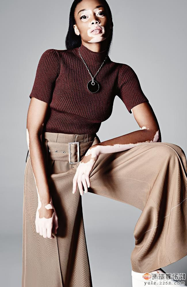 白癜风名模chantelle brown白色透视裙亮相