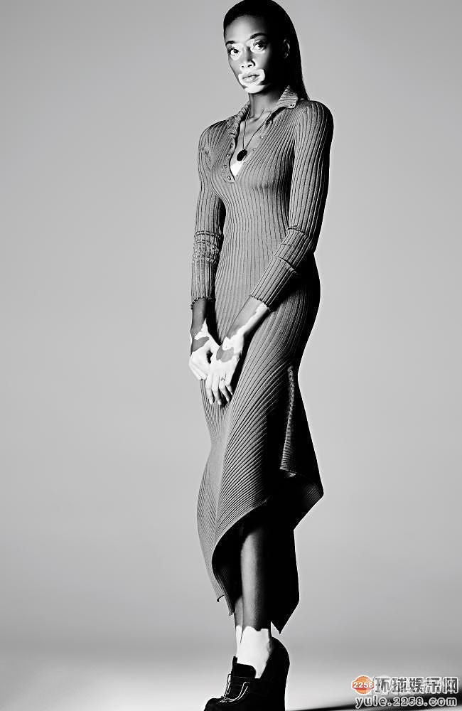 白癜风名模chantelle brown白色透视裙亮相