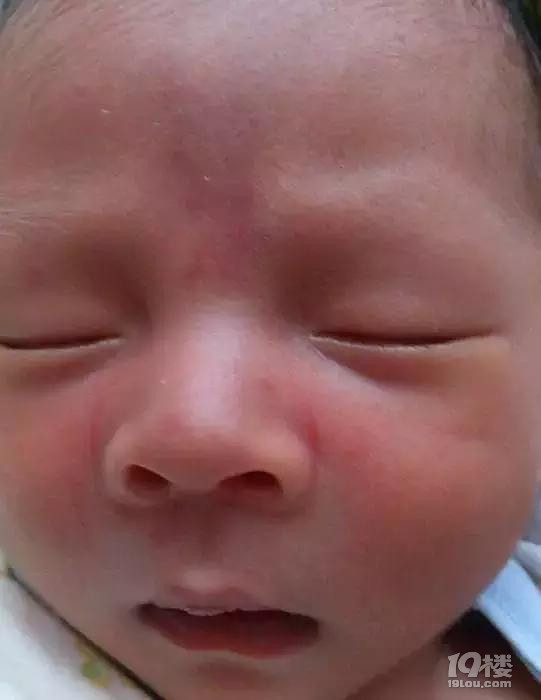 【今日热点】妈妈必看 | 新生儿皮肤问题大汇总