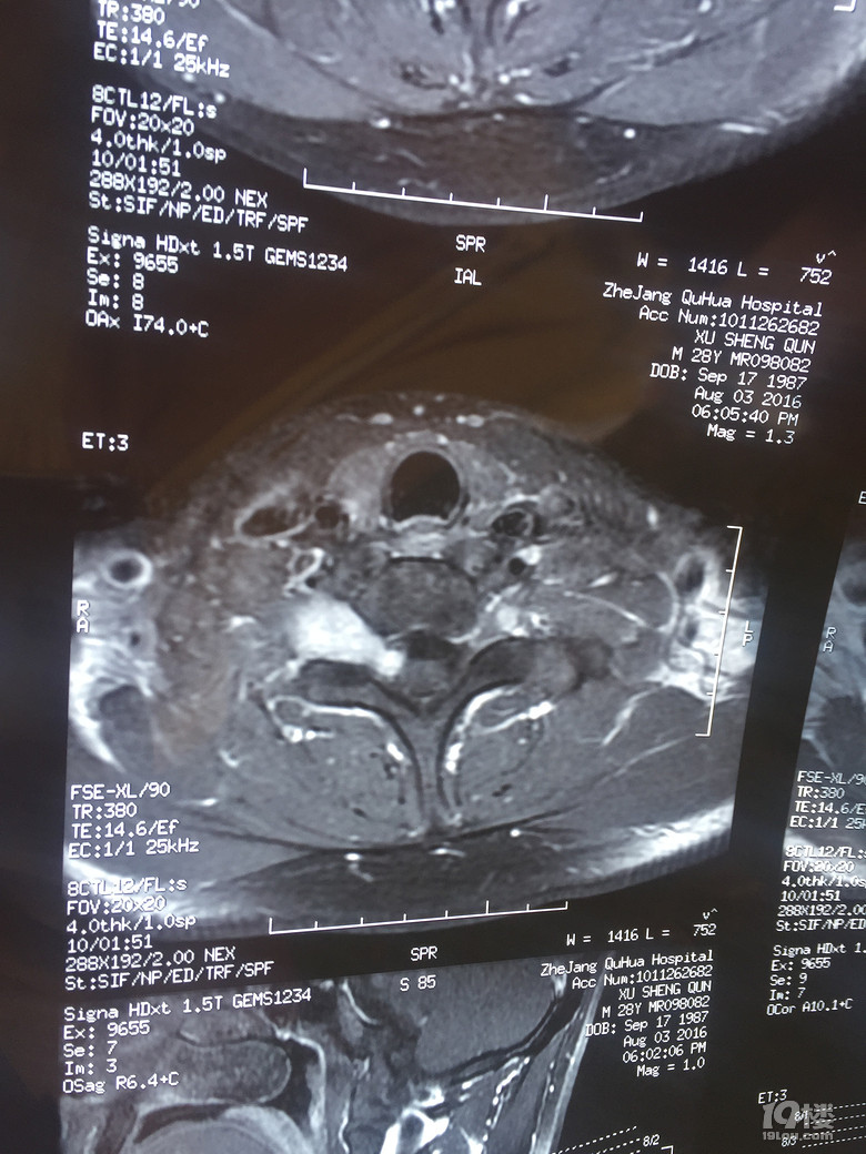 我要动手术了,求推荐【浙二医院脊柱肿瘤科】