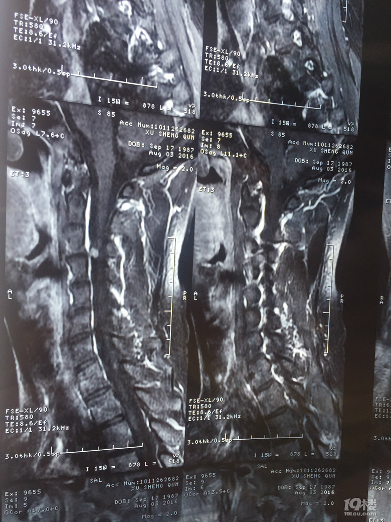 我要动手术了,求推荐【浙二医院脊柱肿瘤科】