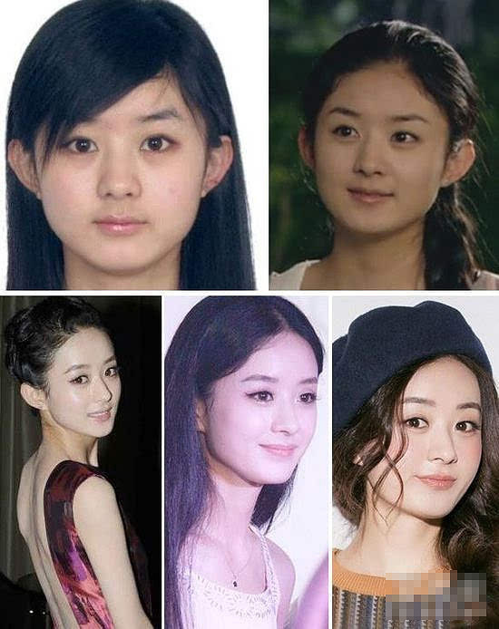 女明星整容后美哭了:杨紫赵丽颖张天爱变女神
