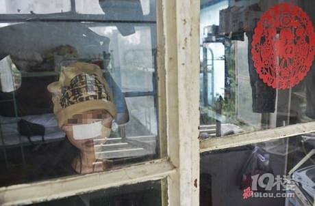 女子遭家暴11年被咬掉鼻子:从来没向别人提