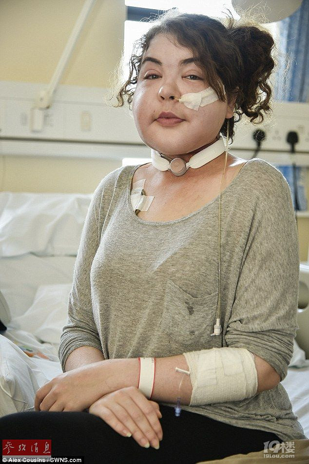 患癌女子被误诊感冒 喉咙肿至两倍或将无法说