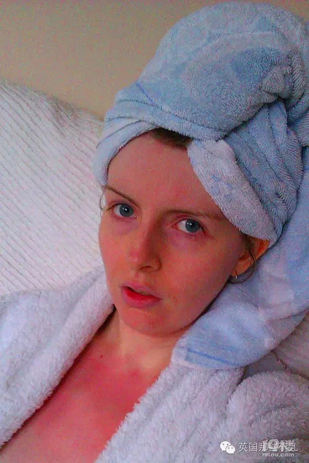 她们对水过敏,即使是蒸馏水,也像是强酸泼在皮