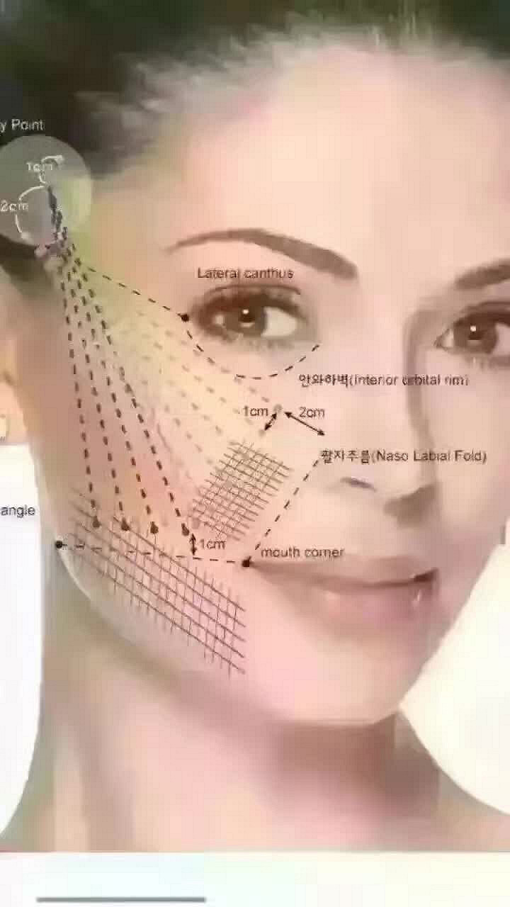 全脸超声刀,您心疼? 满脸皱纹的时候,心