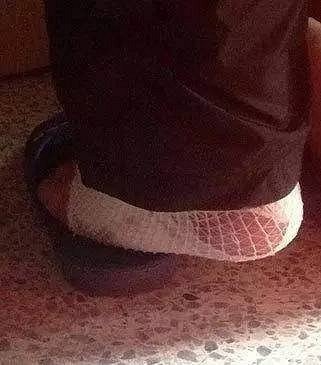 抖腿到底是不是种病