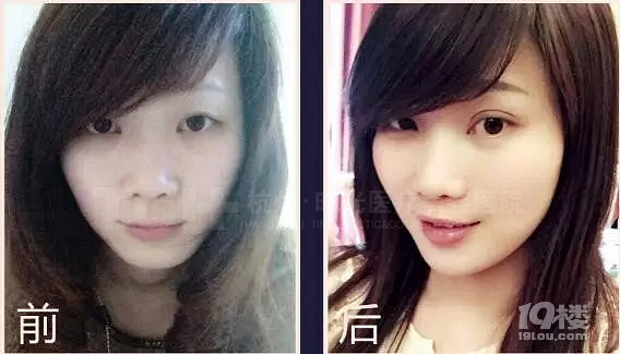 《鬼怪》火了女主爱笑的单眼皮，所以你就以为要逆袭了？！