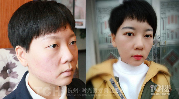 《鬼怪》火了女主爱笑的单眼皮，所以你就以为要逆袭了？！