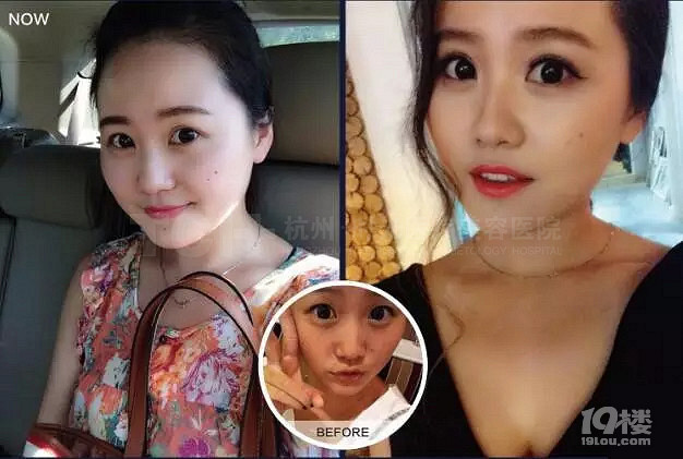 《鬼怪》火了女主爱笑的单眼皮，所以你就以为要逆袭了？！