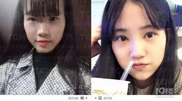 《鬼怪》火了女主爱笑的单眼皮，所以你就以为要逆袭了？！