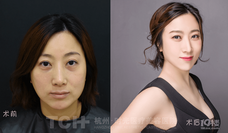 谁说40岁的女人豆腐渣？她40岁+ 却美成了20 岁！