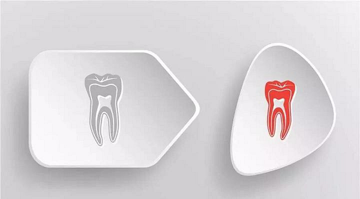 看牙贵?你看得太迟了!_杭州绿城口腔医院__杭