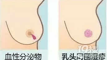 鷿ʲôP(gun)鷿10W(xu)
