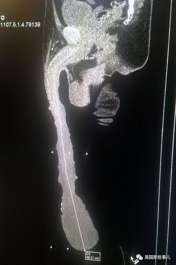 而正如gonzalez医生所说,cabrera迄今还习惯给丁丁绑上厚厚的绷带.