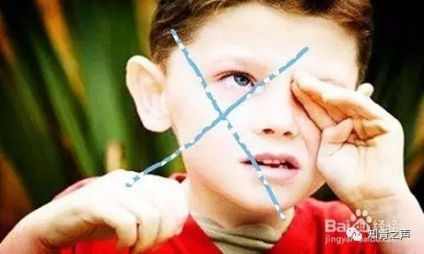 【云南白药热敷蒸汽眼罩】异物入眼怎么办?