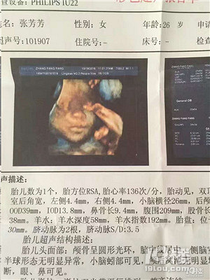 宝宝出生不到1小时！老公半夜跟着急救车走了