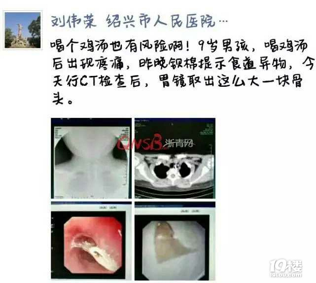 浙江一9岁男孩喝鸡汤补身子,最后却进了医