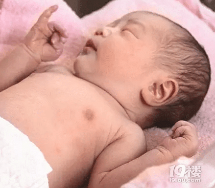 新生儿脐带用什么消毒  正确方法要掌握