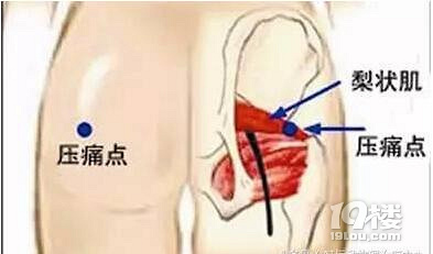 久坐腰不疼,腿麻屁股疼?