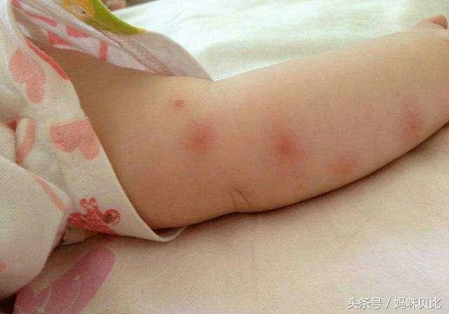 宝宝夏天最怕的三件事,容易引起热感冒、发