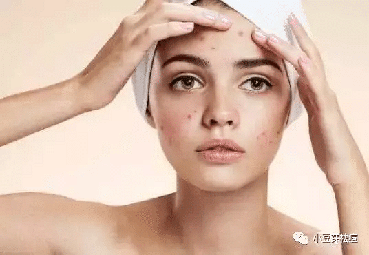 小豆芽老师:女生大姨妈来前为什么会长痘痘?