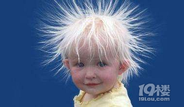 少白头遗传吗 为什么出现少白头