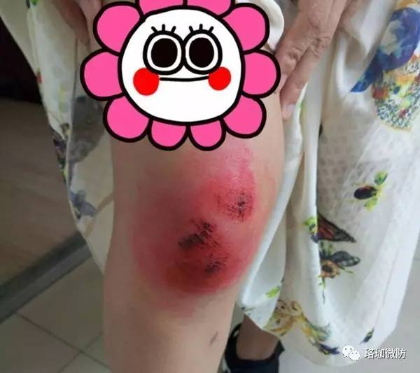 背后真相让所有人都怒了