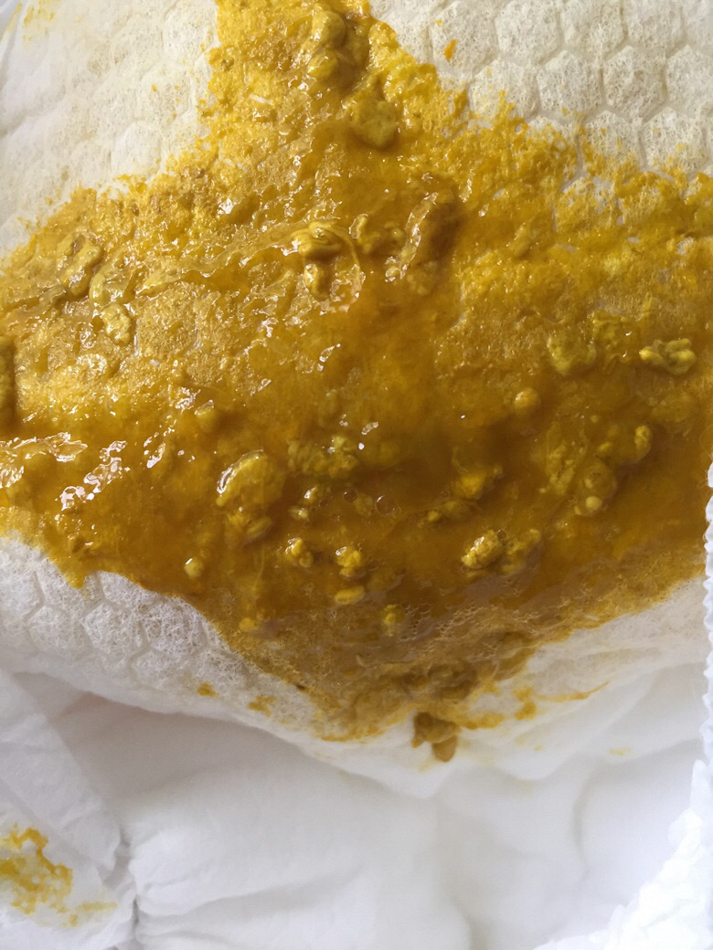 ͼƬ�����Ҫ��ҽ����