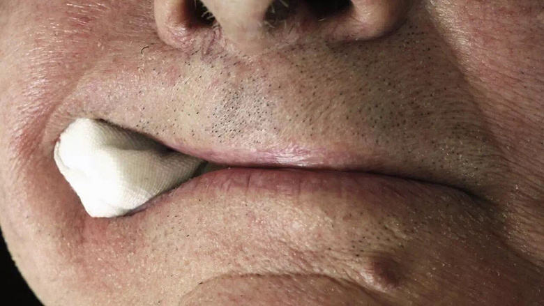 上午拔牙好,还是下午拔牙好?_杭州绿城口腔医