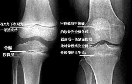 太原中心医院第三医院国庆儿童生长发育公益筛