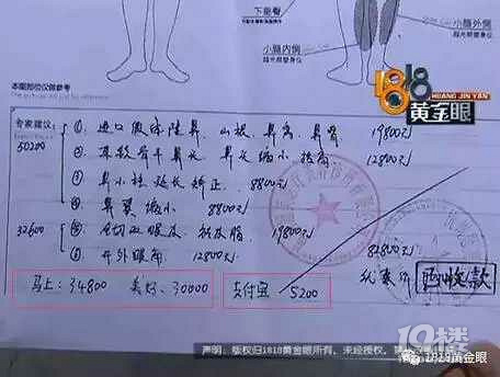 妻子贷款7万整容 丈夫索要明细单:打乱我