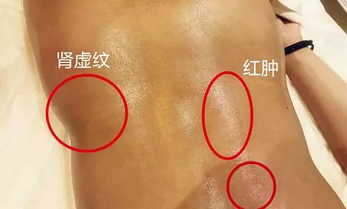 别人都说我看着不胖,老公一摸却嫌我一身赘肉