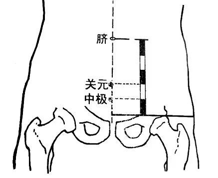脐下五寸位置的示意图图片
