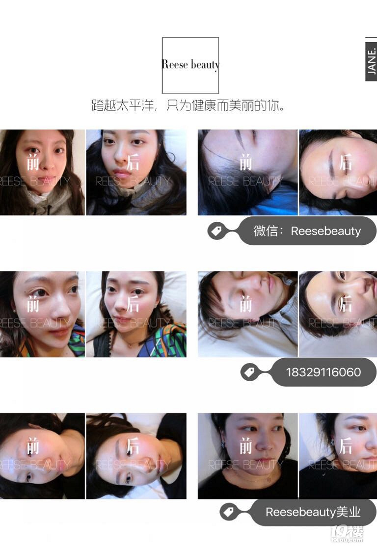 杭州哪里做半永久好?杭州網(wǎng)紅其實(shí)都愛去這家!