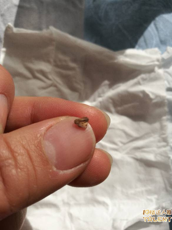 萧山第一人民医院妇科手术后残留物