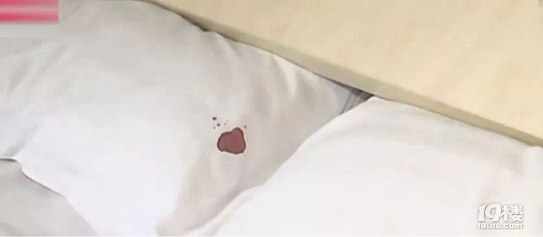 女子酒店熟睡一夜之后,醒来一摸,满脸是血…