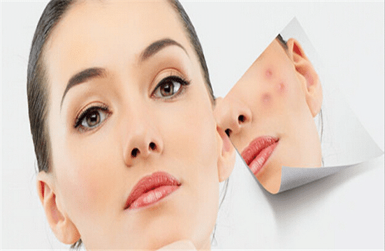 如何消除脸部红血丝效果好?分享不红脸的小妙