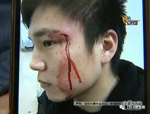 滴滴司机拿出棍子匕首…只因派单太远