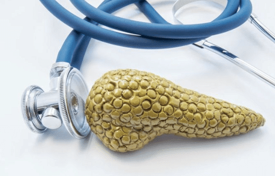 胰腺癌治疗与人参皂苷Rh2的关系