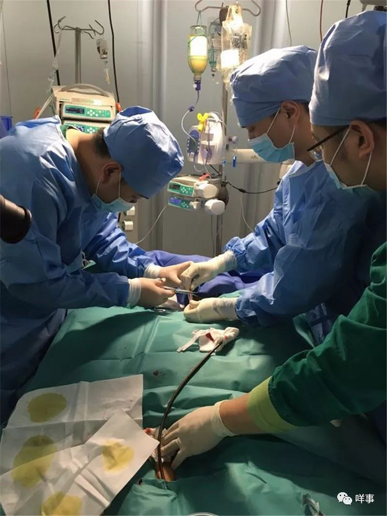 广州夫妇一场流感花了几十万,人救回来了!数闯