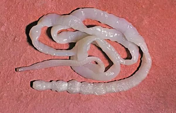 【信偏方出大事】桐乡阿姨乳房里取出虫 因当年生吃3只青