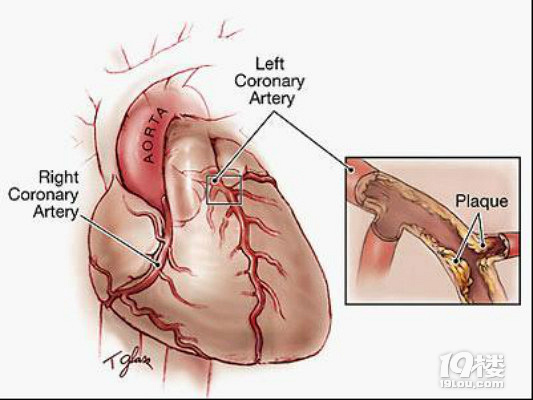 做心脏手术后吃什么好?心脏手术后注意事项有